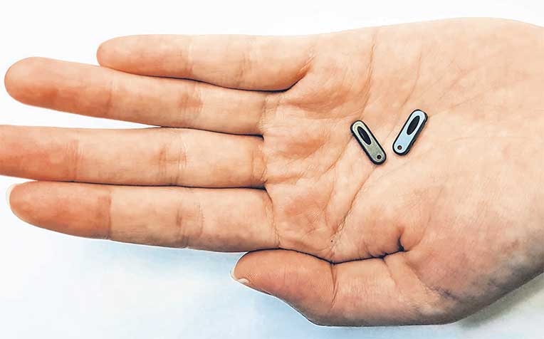  ​is a tiny titanium implant that sits under the skin, helping nurses to slip in a needle exactly the same way each time. This way, the rest of the vein is kept intact.