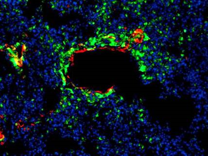 Novel-bio-therapeutics-to-target_image1.png