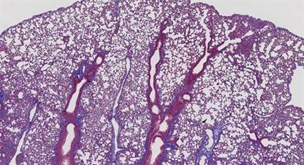 Novel-bio-therapeutics-to-target_image2.png