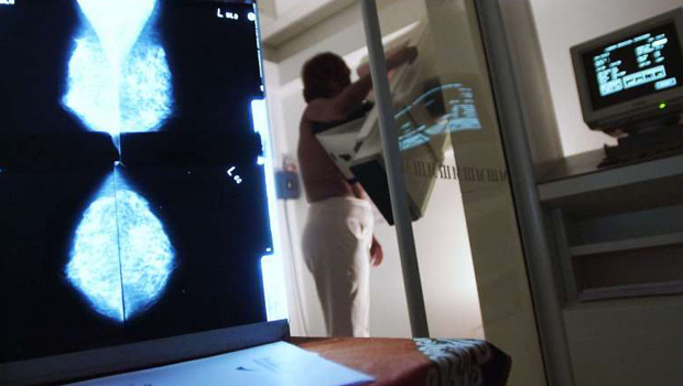  ​Posed photo of a patient going through breast screening.   PHOTO ST FILE