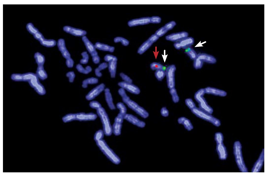 Fluorescence in situ hybridisation (FISH)