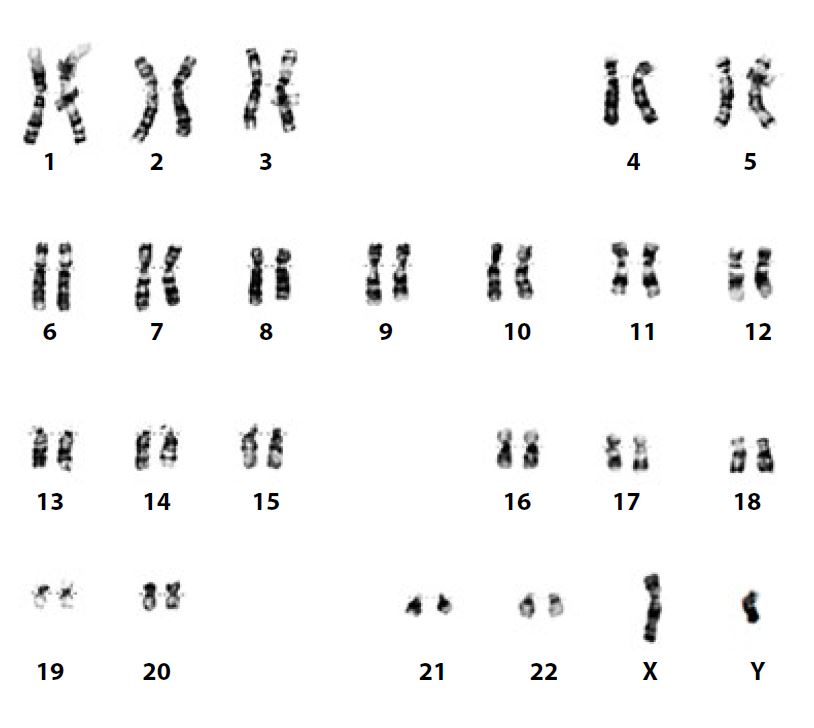 Karyotype