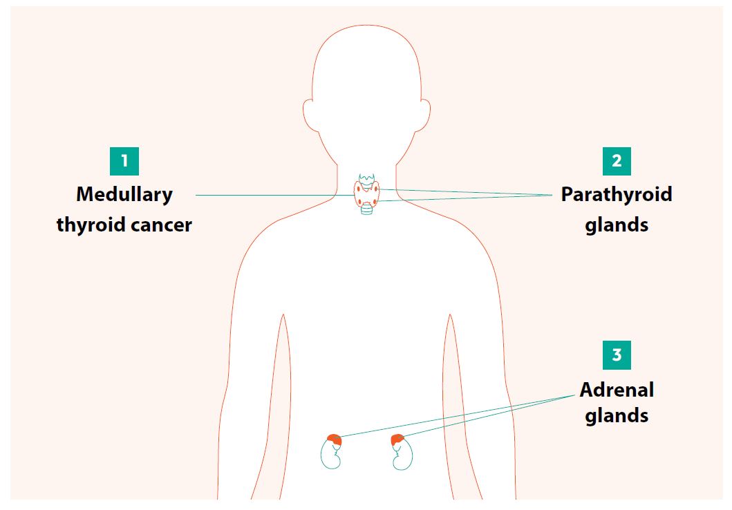 What are the tumours and cancers commonly associated