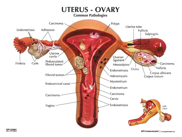 uterine cancer conditions & treatments