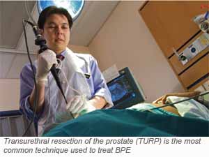 Transurethral resection of the prostate (TURP) - Benign Prostatic Enlargement (BPE) treatment